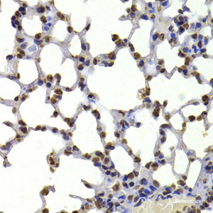 Immunohistochemistry of paraffin-embedded Mouse lung using CBX5 Polyclonal Antibody at dilution of 1:100 (40x lens) .