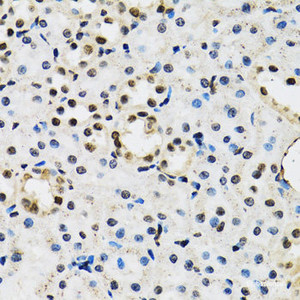 Immunohistochemistry of paraffin-embedded Mouse kidney using JADE1 Polyclonal Antibody at dilution of 1:100 (40x lens) .