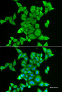 Immunofluorescence analysis of MCF7 cells using STRN3 Polyclonal Antibody