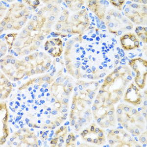 Immunohistochemistry of paraffin-embedded Mouse kidney using TIRAP Polyclonal Antibody at dilution of 1:100 (40x lens) .