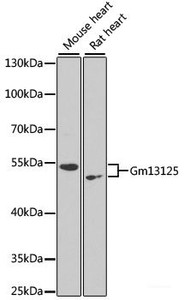 Western blot analysis of extracts of various cell lines using Gm13125 Polyclonal Antibody at dilution of 1:1000.