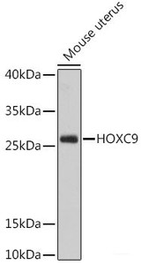 Western blot analysis of extracts of Mouse uterus using HOXC9 Polyclonal Antibody at dilution of 1:1000.