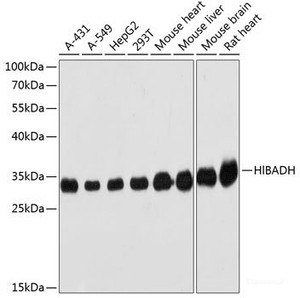 Western blot analysis of extracts of various cell lines using HIBADH Polyclonal Antibody at dilution of 1:3000.