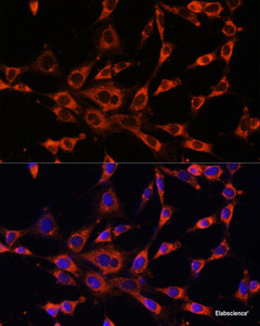 Immunofluorescence analysis of NIH-3T3 cells using ITPR3 Polyclonal Antibody at dilution of 1:100. Blue: DAPI for nuclear staining.