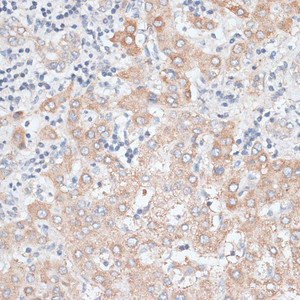 Immunohistochemistry of paraffin-embedded Human liver using GPC4 Polyclonal Antibody at dilution of 1:100 (40x lens) .