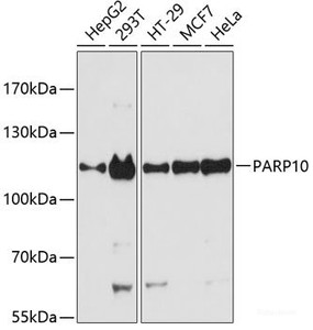 Western blot analysis of extracts of various cell lines using PARP10 Polyclonal Antibody at dilution of 1:3000.