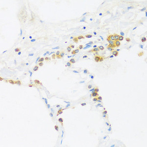 Immunohistochemistry of paraffin-embedded Human lung using C1GALT1 Polyclonal Antibody at dilution of 1:100 (40x lens) .