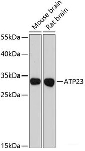 Western blot analysis of extracts of various cell lines using ATP23 Polyclonal Antibody at dilution of 1:3000.