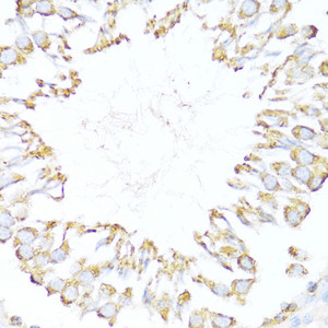 Immunohistochemistry of paraffin-embedded Rat testis using DNAJB11 Polyclonal Antibody at dilution of 1:100 (40x lens) .