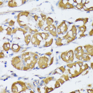 Immunohistochemistry of paraffin-embedded Human stomach using VAPA Polyclonal Antibody at dilution of 1:100 (40x lens) .