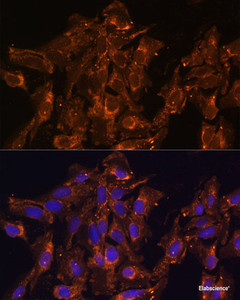 Immunofluorescence analysis of U-2 OS cells using HSD17B8 Polyclonal Antibody at dilution of 1:100 (40x lens) . Blue: DAPI for nuclear staining.
