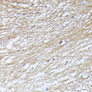 Immunohistochemistry of paraffin-embedded Rat brain using SEPT5 Polyclonal Antibody at dilution of 1:100 (40x lens) .