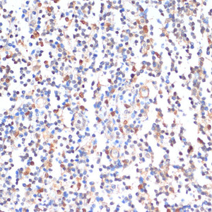 Immunohistochemistry of paraffin-embedded Human tonsil using ZMYM3 Polyclonal Antibody at dilution of 1:100 (40x lens) .