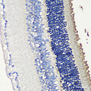 Immunohistochemistry of paraffin-embedded Mouse retina using SAG Polyclonal Antibody at dilution of 1:200 (40x lens) .