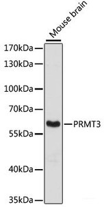 Western blot analysis of extracts of Mouse brain using PRMT3 Polyclonal Antibody at dilution of 1:3000.