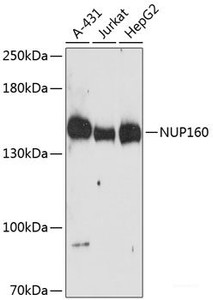 Western blot analysis of extracts of various cell lines using NUP160 Polyclonal Antibody at dilution of 1:3000.