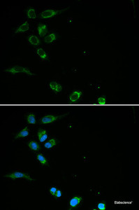 Immunofluorescence analysis of MCF-7 cells using HFE Polyclonal Antibody