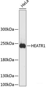 Western blot analysis of extracts of HeLa cells using HEATR1 Polyclonal Antibody at dilution of 1:3000.