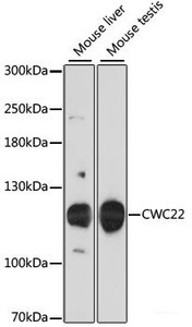 Western blot analysis of extracts of various cell lines using CWC22 Polyclonal Antibody at dilution of 1:3000.