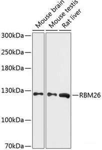 Western blot analysis of extracts of various cell lines using RBM26 Polyclonal Antibody at dilution of 1:3000.