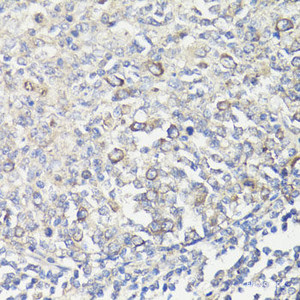 Immunohistochemistry of paraffin-embedded Human tonsil using MUL1 Polyclonal Antibody at dilution of 1:100 (40x lens) .