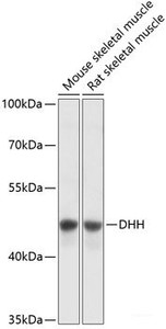 Western blot analysis of extracts of various cell lines using DHH Polyclonal Antibody at dilution of 1:3000.