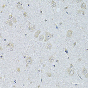 Immunohistochemistry of paraffin-embedded Rat brain using SLC29A1 Polyclonal Antibody at dilution of 1:100 (40x lens) .