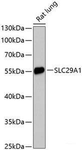 Western blot analysis of extracts of Rat lung using SLC29A1 Polyclonal Antibody at dilution of 1:3000.