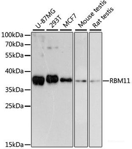 Western blot analysis of extracts of various cell lines using RBM11 Polyclonal Antibody at dilution of 1:3000.