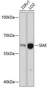 Western blot analysis of extracts of various cell lines using SIAE Polyclonal Antibody at dilution of 1:3000.
