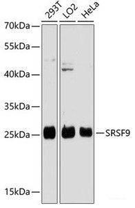 Western blot analysis of extracts of various cell lines using SFRS9 Polyclonal Antibody at dilution of 1:3000.