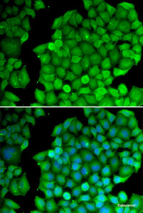 Immunofluorescence analysis of U2OS cells using Cyclin D2 Polyclonal Antibody
