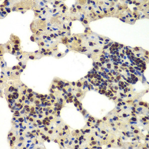 Immunohistochemistry of paraffin-embedded Rat lung using DDX5 Polyclonal Antibody at dilution of 1:100 (40x lens) .