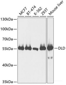 Western blot analysis of extracts of various cell lines using DLD Polyclonal Antibody at dilution of 1:1000.