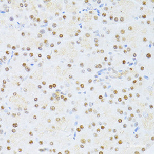 Immunohistochemistry of paraffin-embedded Rat pancreas using ETV1 Polyclonal Antibody at dilution of 1:100 (40x lens) .