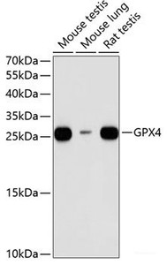Western blot analysis of extracts of various cell lines using GPX4 Polyclonal Antibody at dilution of 1:1000.