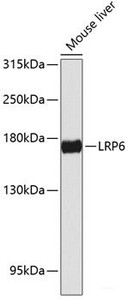 Western blot analysis of extracts of Mouse liver using LRP6 Polyclonal Antibody at dilution of 1:1000.