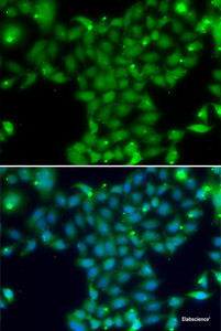 Immunofluorescence analysis of U2OS cells using TGM5 Polyclonal Antibody