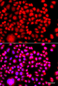 Immunofluorescence analysis of A549 cells using TESK2 Polyclonal Antibody