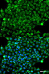 Immunofluorescence analysis of A549 cells using CFHR3 Polyclonal Antibody