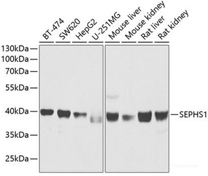 Western blot analysis of extracts of various cell lines using SEPHS1 Polyclonal Antibody at dilution of 1:1000.