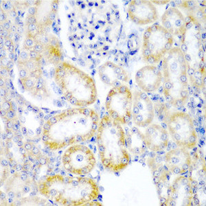 Immunohistochemistry of paraffin-embedded Rat kidney using UPF2 Polyclonal Antibody at dilution of 1:200 (40x lens) .