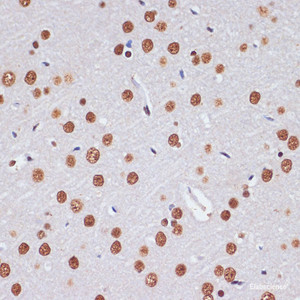 Immunohistochemistry of paraffin-embedded Rat brain using PELP1 Polyclonal Antibody at dilution of 1:100 (40x lens) .