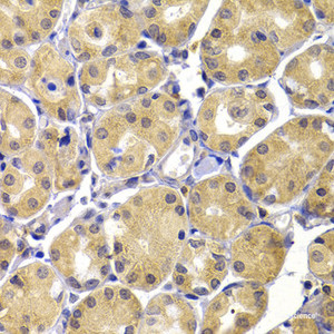 Immunohistochemistry of paraffin-embedded Human stomach using UBIAD1 Polyclonal Antibody at dilution of 1:100 (40x lens) .