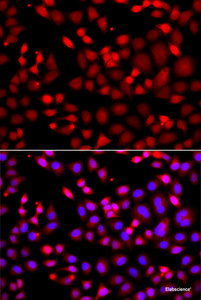 Immunofluorescence analysis of A549 cells using MTUS1 Polyclonal Antibody
