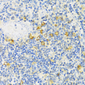 Immunohistochemistry of paraffin-embedded Human tonsil using MLKL Polyclonal Antibody at dilution of 1:100 (40x lens) .