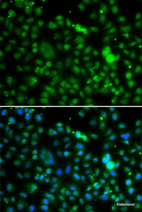 Immunofluorescence analysis of MCF-7 cells using NSUN6 Polyclonal Antibody
