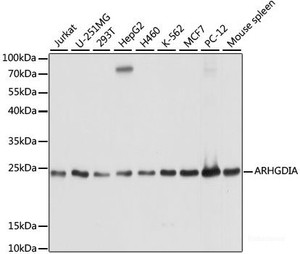 Western blot analysis of extracts of various cell lines using ARHGDIA Polyclonal Antibody at dilution of 1:1000.