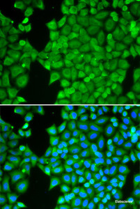 Immunofluorescence analysis of HeLa cells using CA3 Polyclonal Antibody