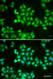 Immunofluorescence analysis of HeLa cells using CHD2 Polyclonal Antibody